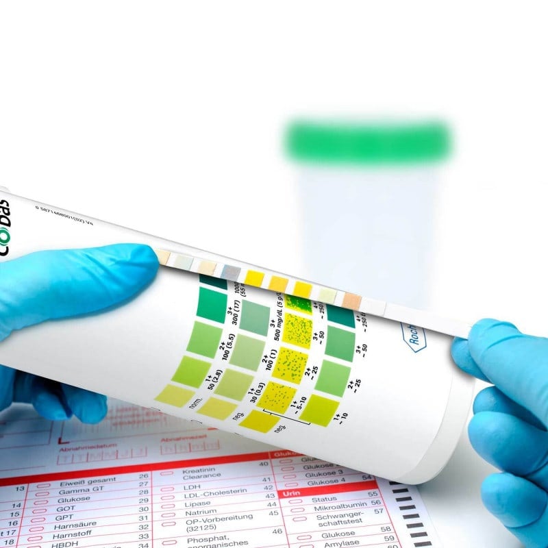 Combur 3 Test E, 50 PCS