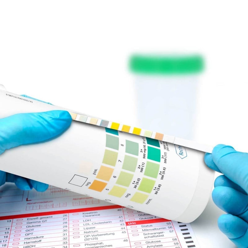 Combur 4 Test N, 50 PCS