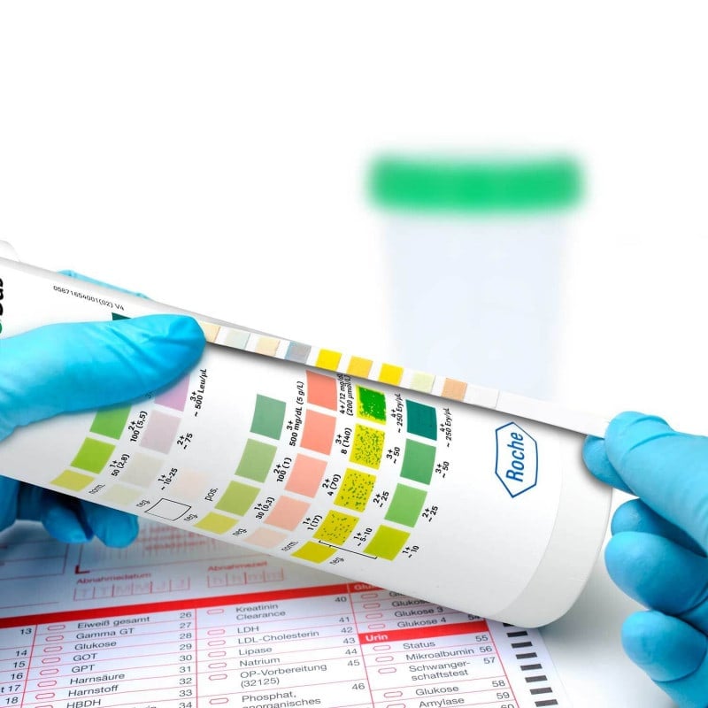 Combur 6 Test, 50 PCS