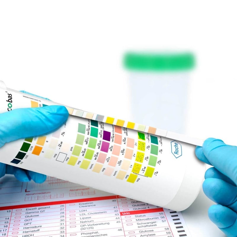 Combur 10 Test, 100 pcs.