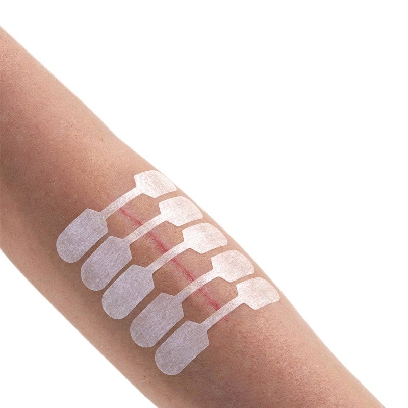 Sterigrap Wound Closure Strips Strips, 75 x 6 mm (6 PCS)