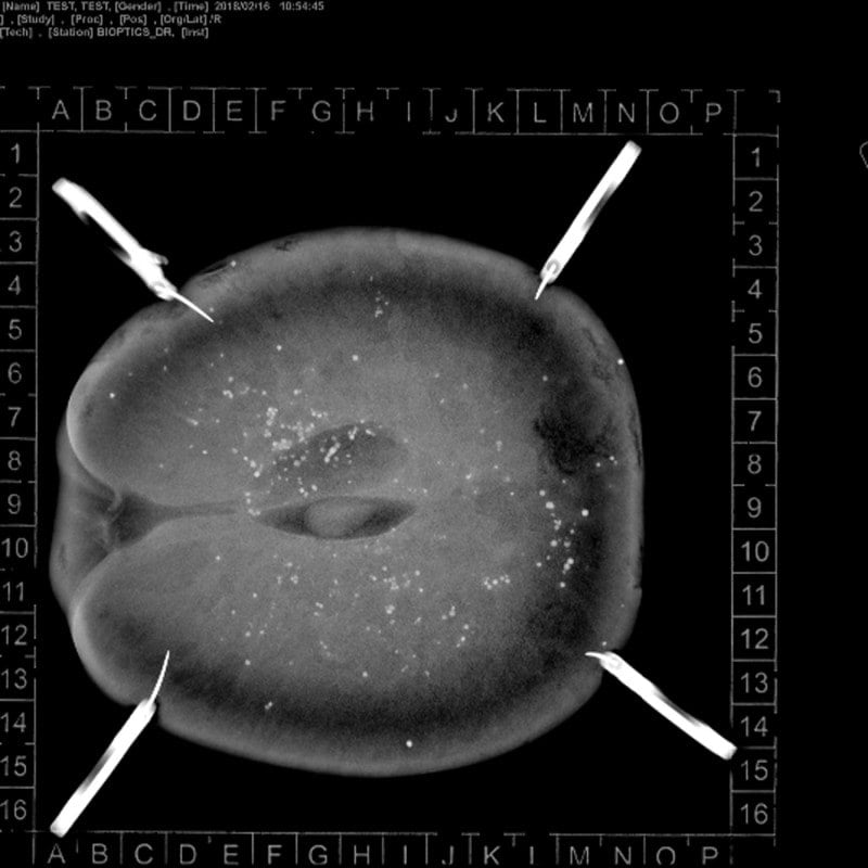 KLINITRAY™ Mammary Plates R | Large