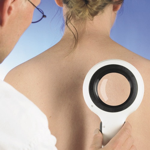 DermLite Lumio, Magnifying Light Dermatoscope UV-LED