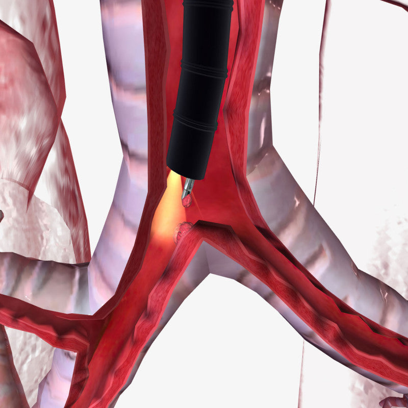 HD-500 Video Bronchoscope
