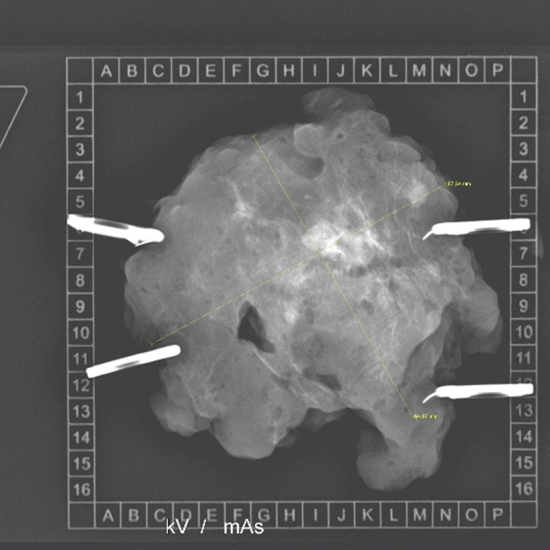 KLINITRAY™ Mammary Plates R | Large