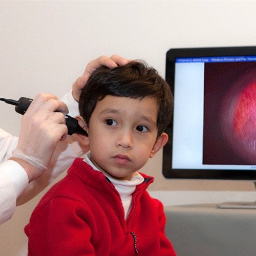 Firefly Video Otoscope DE550 (wireless transfer)