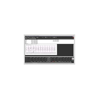 SmartHolter24 Holter ECG Device
