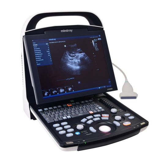 Mindray DP 30 with battery | convex transducer (35C50EA)