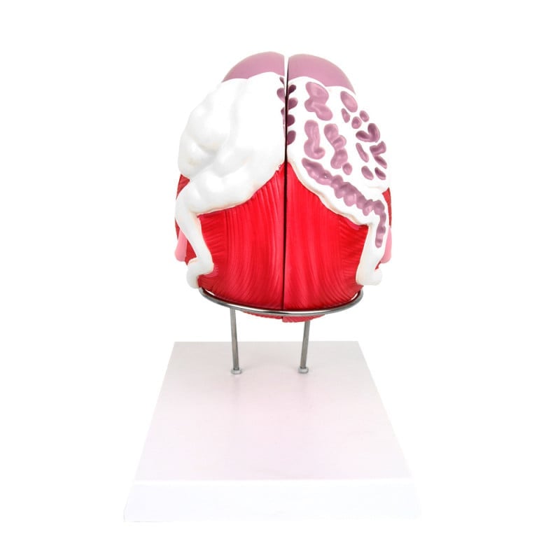 Anatomical Model of the Male Bladder