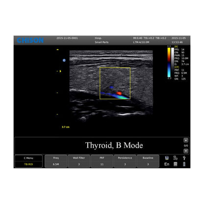 CHISON ECO5 incl. Ultrasound Trolley with convex probe