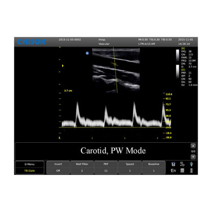 CHISON ECO3 Expert Ultrasound Machine with linear transducer (L7M-A)