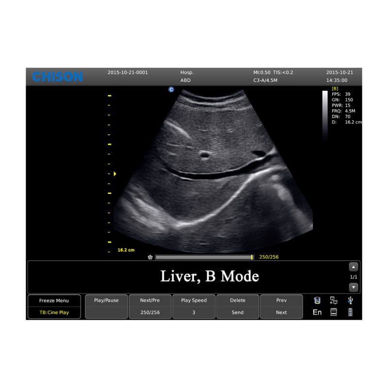 CHISON ECO3 Expert Ultrasound Machine with linear transducer (L7M-A)