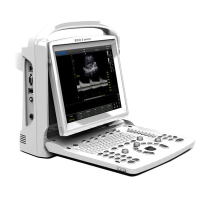 CHISON ECO3 Expert Ultrasound Machine with linear transducer (L7M-A)
