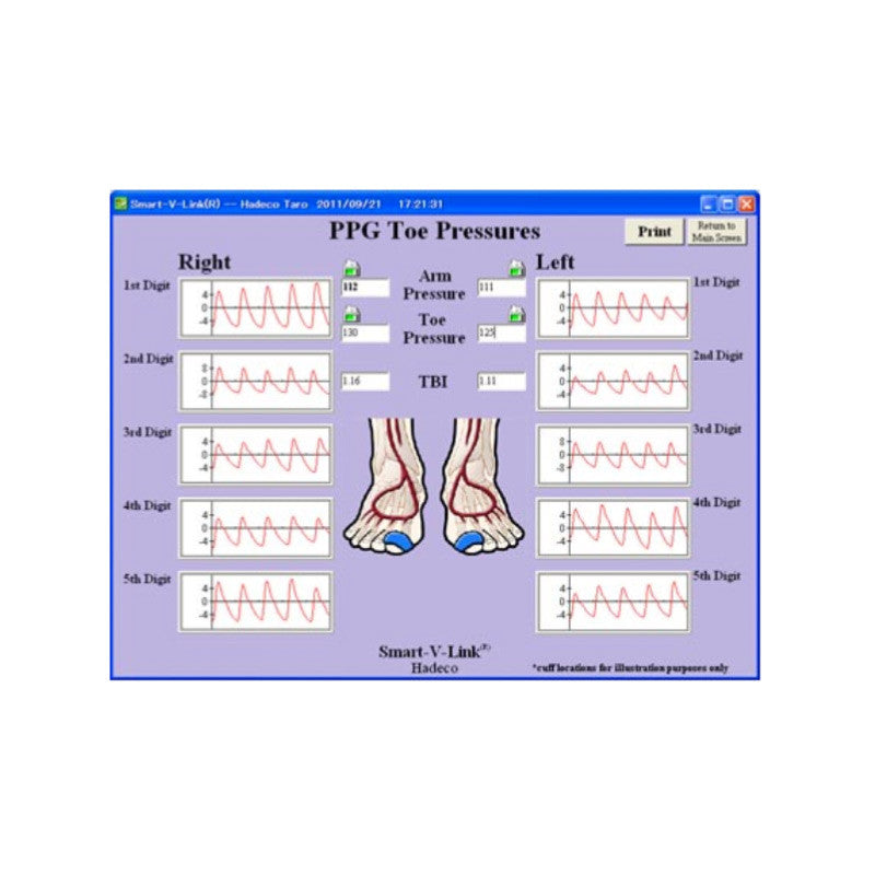 Smart-V-Link Software