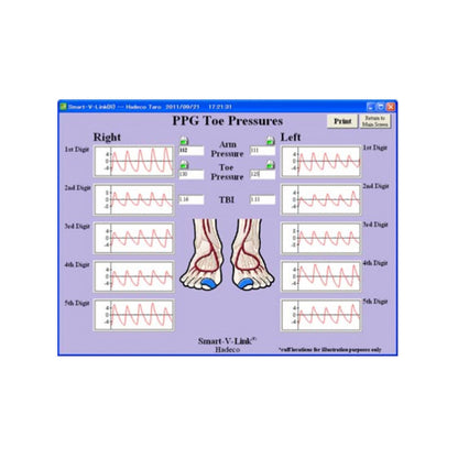 Smart-V-Link Software