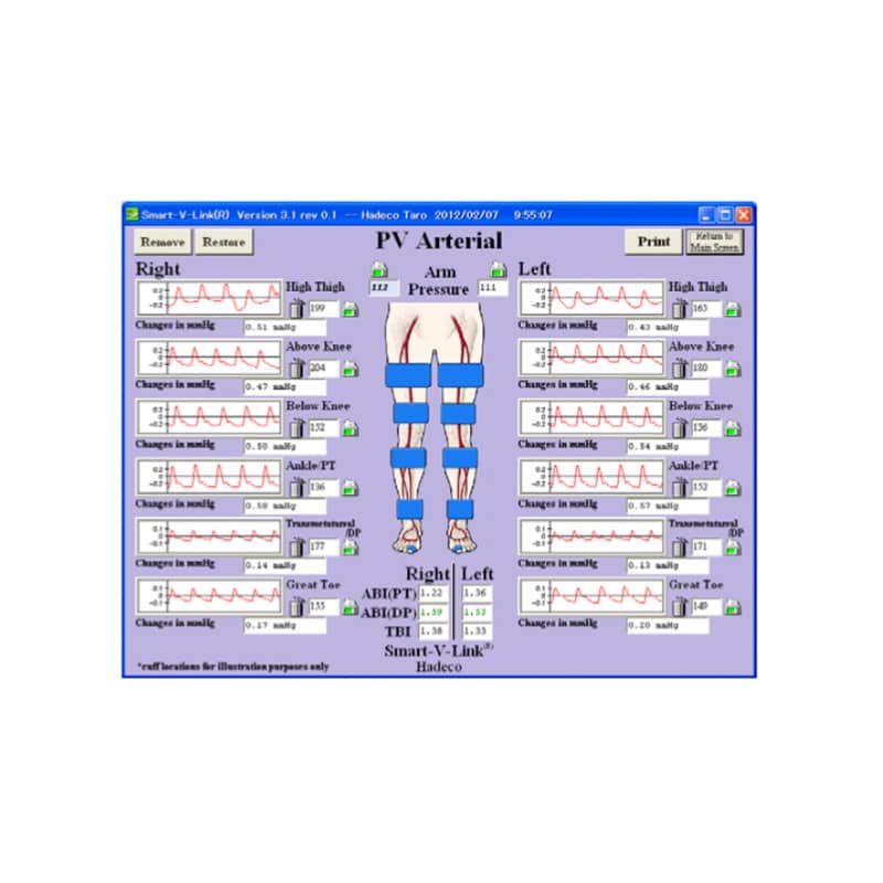 Smart-V-Link Software