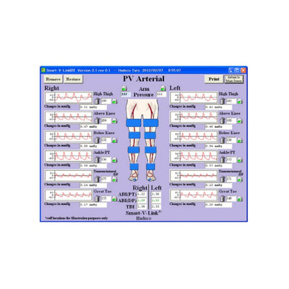 Smart-V-Link Software