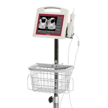 Vitascan PD+ Bladder Scanner