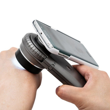DermoScan Smartphone Adapter for Samsung Galaxy S8