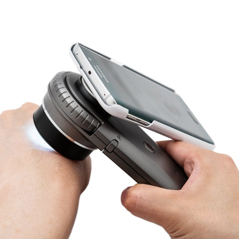 DermoScan Smartphone Adapter for Samsung Galaxy Note 5
