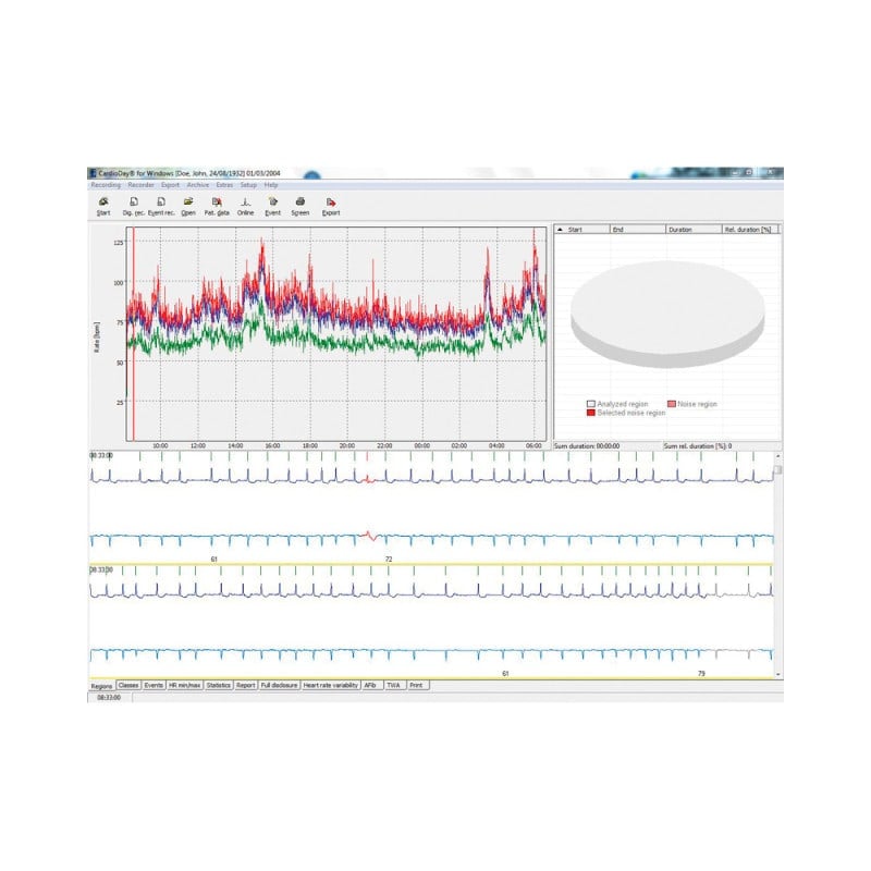 GE SEER 1000 Multi-Channel Digital Holter Recorder with CardioDay Easy software