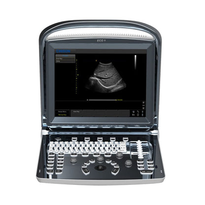 CHISON ECO1 incl. Ultrasound Trolley without battery | with convex probe