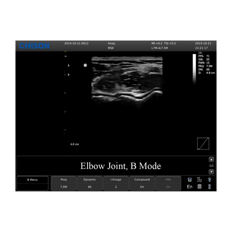 Chison ECO 1 Ultrasound Machine without rechargeable battery | convex transducer (C3-A)