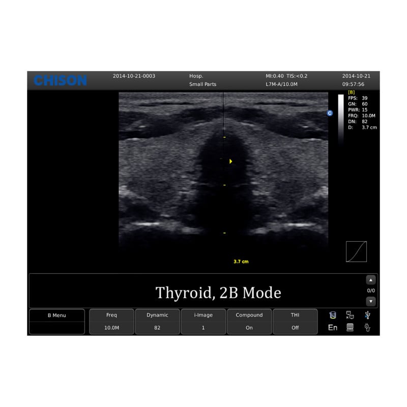 Chison ECO 1 Ultrasound Machine with rechargeable battery | convex transducer (C3-A)