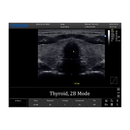 Chison ECO 1 Ultrasound Machine with rechargeable battery | convex transducer (C3-A)
