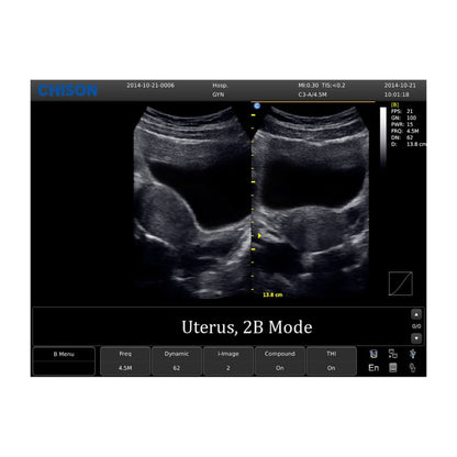 Chison ECO 1 Ultrasound Machine without rechargeable battery | convex transducer (C3-A)