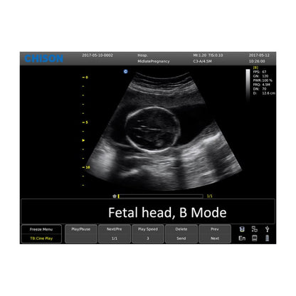 CHISON ECO6 incl. Ultrasound Trolley with convex probe & P3-A phased array probe