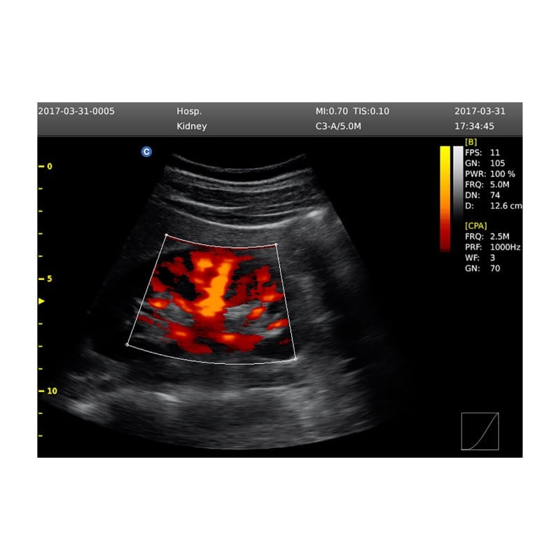 CHISON ECO6 incl. Ultrasound Trolley with convex probe & P3-A phased array probe