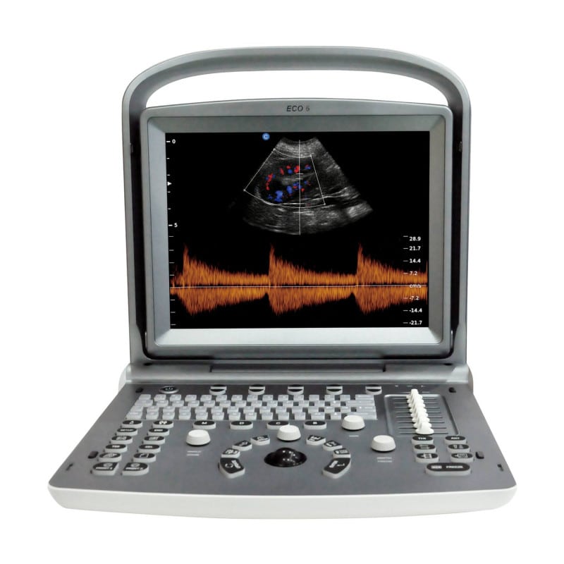Chison ECO 6 Ultrasound Machine with L7M-A linear transducer