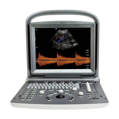 Chison ECO 6 Ultrasound Machine with L7M-A linear transducer