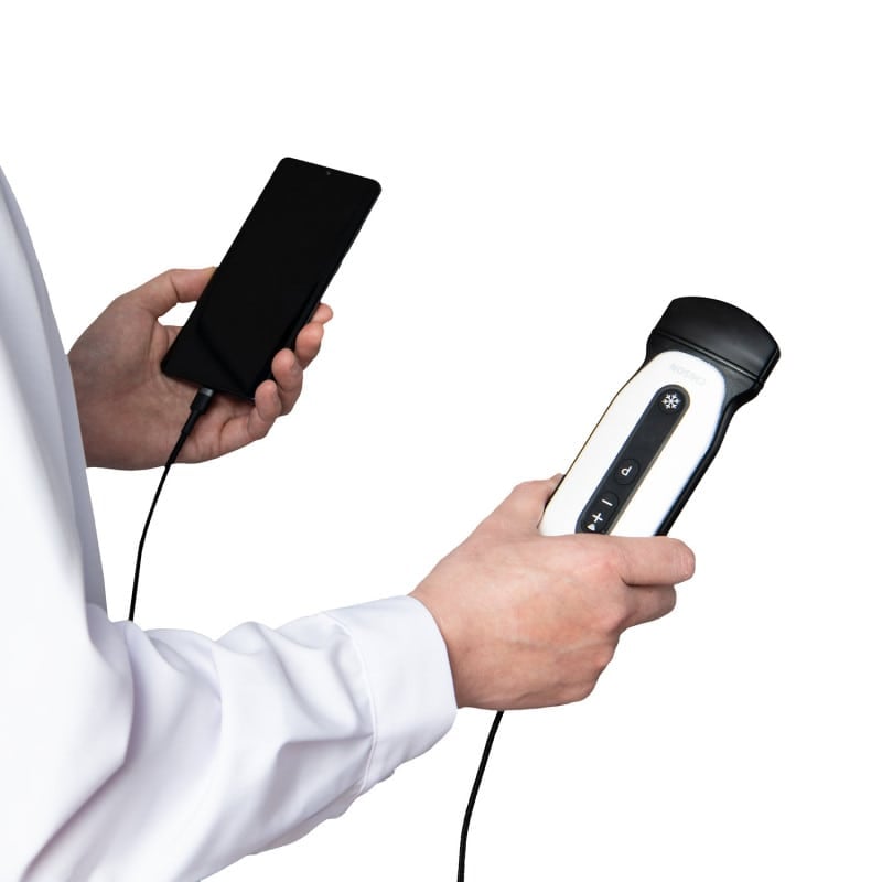 Chison Portable Ultrasound Machine “SonoEye” P3 (with 3.0 MHz phased array transducer)