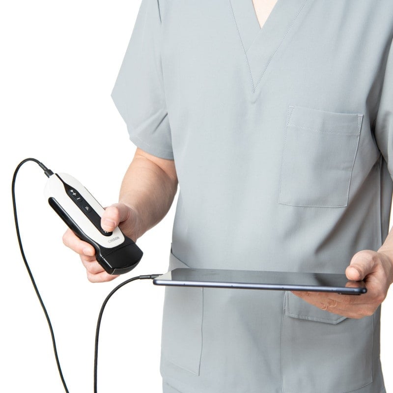 Chison Portable Ultrasound Machine “SonoEye” P6 (with 6.0 MHz micro-convex probe)