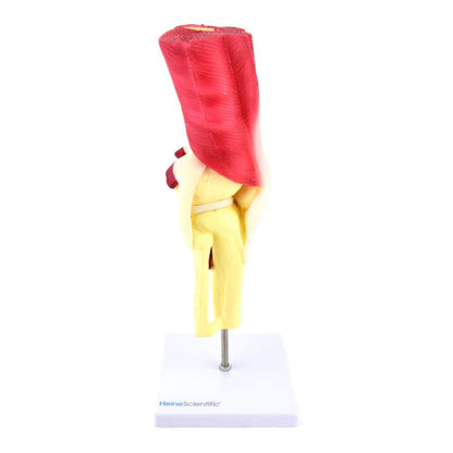 Knee Model