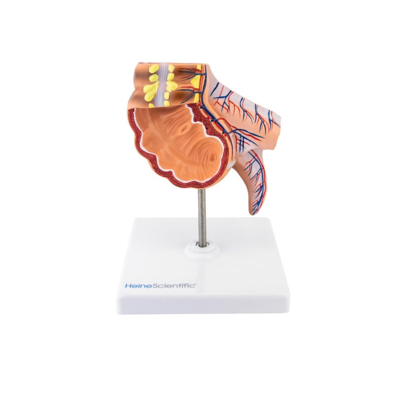 Appendix Model