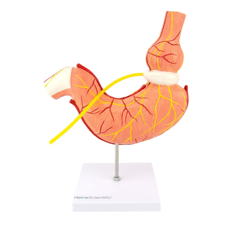 Stomach Model with Gastric Band