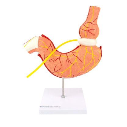 Stomach Model with Gastric Band