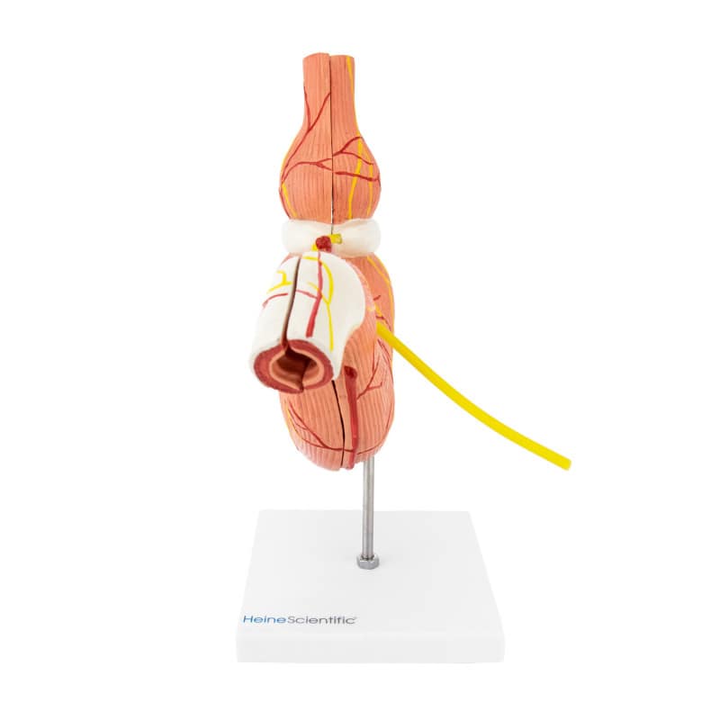 Stomach Model with Gastric Band