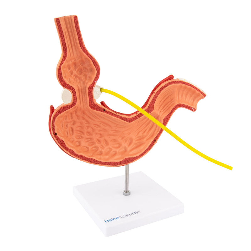 Stomach Model with Gastric Band