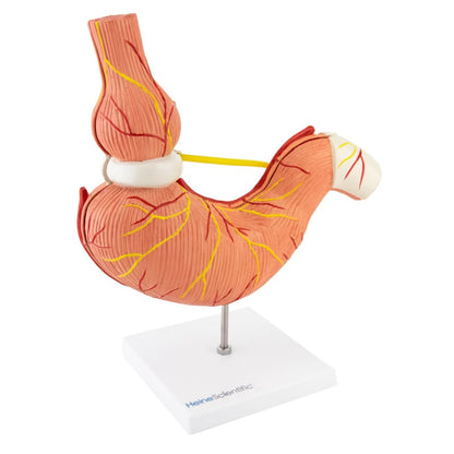 Stomach Model with Gastric Band