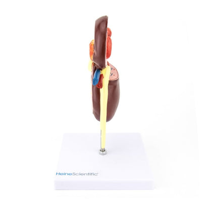 Kidney Model with Diseases