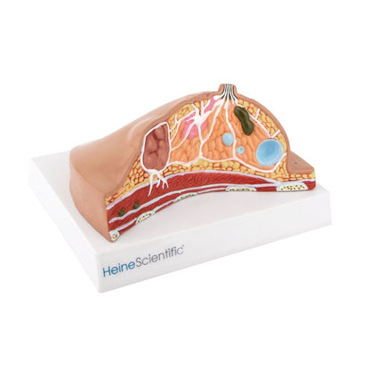 Female Breast Model with Diseases