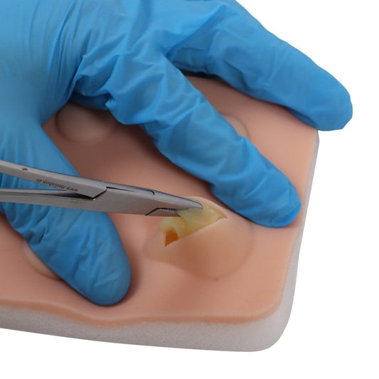 Training Pad Cyst and Abscess