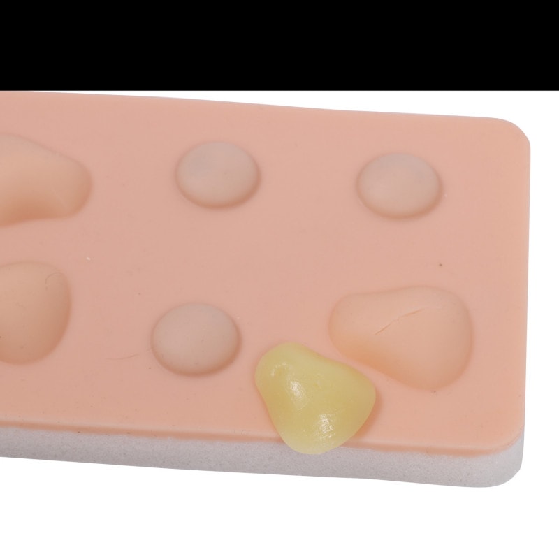 Training Pad Cyst and Abscess