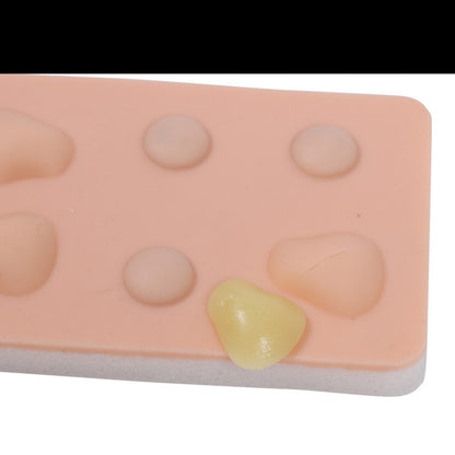 Training Pad Cyst and Abscess