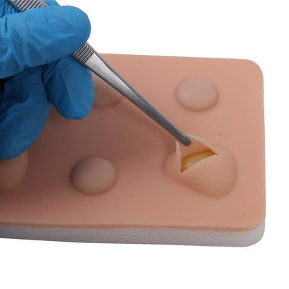 Training Pad Cyst and Abscess