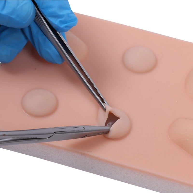 Training Pad Cyst and Abscess